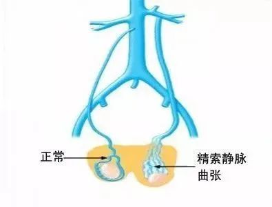 阴囊毛细血管图片